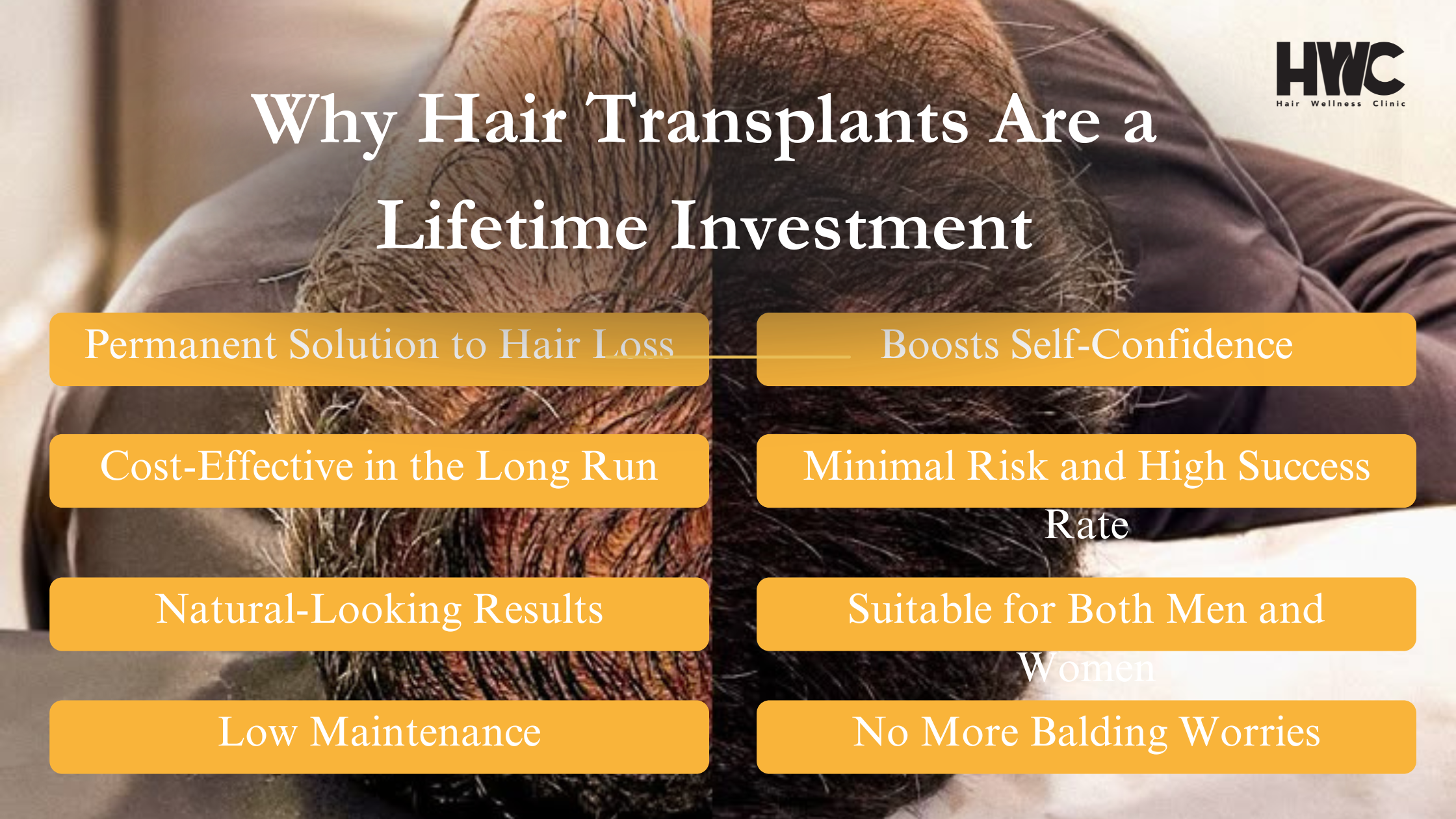 Why Hair Transplants Are a Lifetime
                            Investment